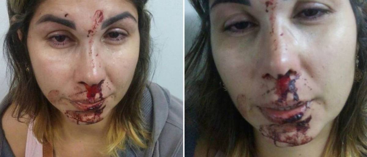  Mulher é agredida pelo marido e filho denuncia caso em rede social