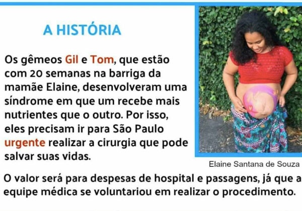 Grávida de gêmeos já está em São Paulo para fazer cirurgia