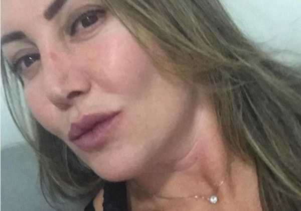Paisagista mostra rosto em recuperação, 14 dias após agressões