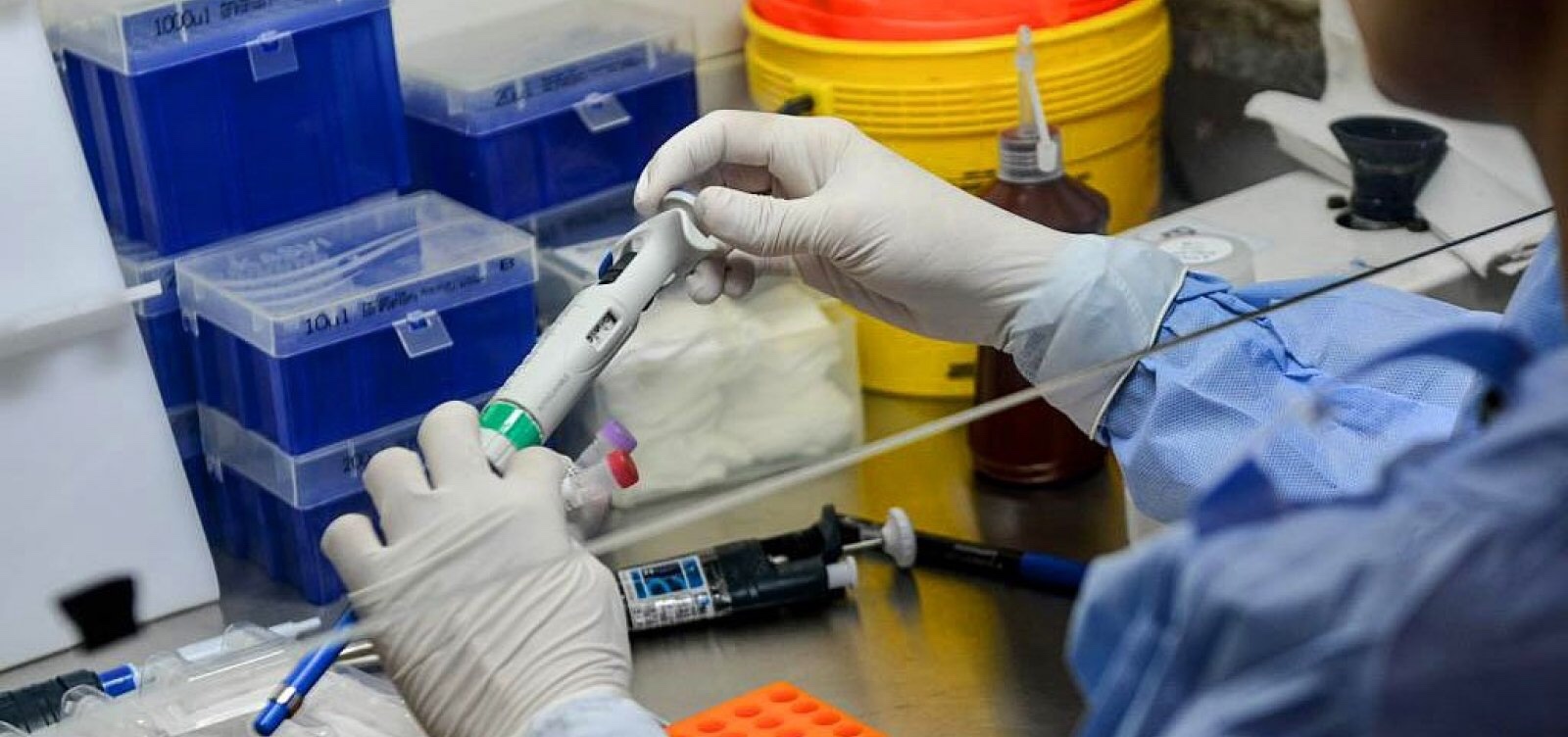Casos subnotificados: números de infectados por coronavírus é quinze vezes maior no Brasil, diz estudo