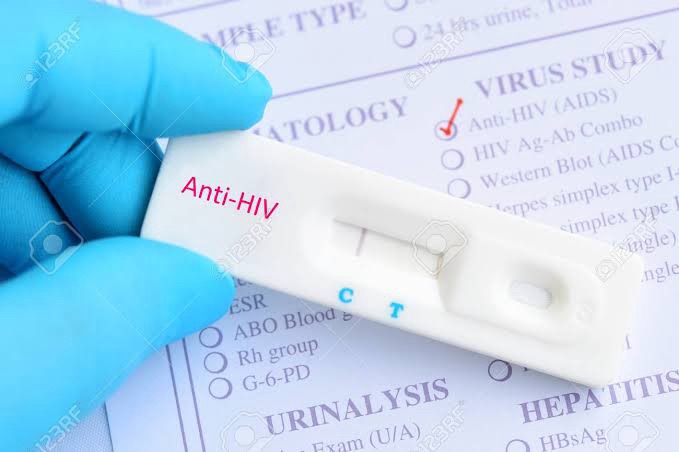 Bahia não registra surto de HIV/Aids entre jovens, confirma Sesab